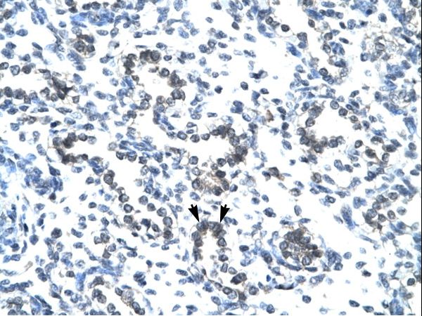 EVX1 Antibody - EVX1 antibody P100830_T100-NP_001980-EVX1 (even-skipped homeobox 1) Antibody was used in IHC to stain formalin-fixed, paraffin-embedded human lung.  This image was taken for the unconjugated form of this product. Other forms have not been tested.
