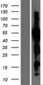 EVX1 Protein - Western validation with an anti-DDK antibody * L: Control HEK293 lysate R: Over-expression lysate