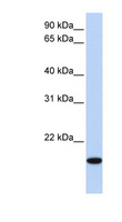 EVX2 Antibody - EVX2 antibody Western blot of HeLa lysate. This image was taken for the unconjugated form of this product. Other forms have not been tested.
