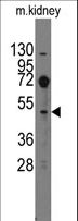 EVX2 Antibody - Western blot of anti-Evx2 antibody in mouse kidney tissue lysates (35 ug/lane). Evx2(arrow) was detected using the purified antibody.