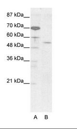 EVX2 Antibody - A: Marker, B: HepG2 Cell Lysate.  This image was taken for the unconjugated form of this product. Other forms have not been tested.