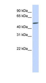 EVX2 Antibody - EVX2 antibody Western blot of Fetal Brain lysate. This image was taken for the unconjugated form of this product. Other forms have not been tested.