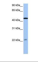 EWSR1 / EWS Antibody - Jurkat cell lysate. Antibody concentration: 0.5 ug/ml. Gel concentration: 12%.  This image was taken for the unconjugated form of this product. Other forms have not been tested.