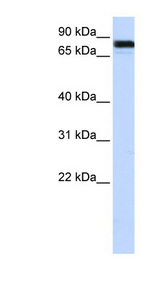EWSR1 / EWS Antibody - EWSR1 antibody Western blot of HepG2 cell lysate. This image was taken for the unconjugated form of this product. Other forms have not been tested.