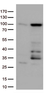 EWSR1 / EWS Antibody - HEK293T cells were transfected with the pCMV6-ENTRY control. (Left lane) or pCMV6-ENTRY EWSR1. (Right lane) cDNA for 48 hrs and lysed. Equivalent amounts of cell lysates. (5 ug per lane) were separated by SDS-PAGE and immunoblotted with anti-EWSR1. (1:500)