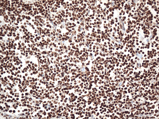 EWSR1 / EWS Antibody - Immunohistochemical staining of paraffin-embedded Human tonsil within the normal limits using anti-EWSR1 mouse monoclonal antibody. (Heat-induced epitope retrieval by 1mM EDTA in 10mM Tris buffer. (pH8.5) at 120°C for 3 min. (1:500)