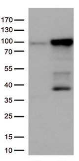 EWSR1 / EWS Antibody - HEK293T cells were transfected with the pCMV6-ENTRY control. (Left lane) or pCMV6-ENTRY EWSR1. (Right lane) cDNA for 48 hrs and lysed. Equivalent amounts of cell lysates. (5 ug per lane) were separated by SDS-PAGE and immunoblotted with anti-EWSR1. (1:500)