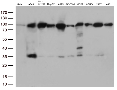 EWSR1 / EWS Antibody - Western blot analysis of extracts. (35ug) from 10 different cell lines by using anti-EWSR1 monoclonal antibody. (1:500)