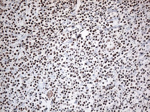 EWSR1 / EWS Antibody - Immunohistochemical staining of paraffin-embedded Human tonsil within the normal limits using anti-EWSR1 mouse monoclonal antibody. (Heat-induced epitope retrieval by 1mM EDTA in 10mM Tris buffer. (pH8.5) at 120°C for 3 min. (1:500)