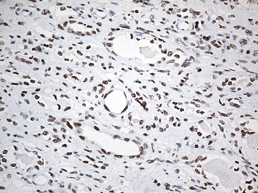 EWSR1 / EWS Antibody - Immunohistochemical staining of paraffin-embedded Human Kidney tissue within the normal limits using anti-EWSR1 mouse monoclonal antibody. (Heat-induced epitope retrieval by 1mM EDTA in 10mM Tris buffer. (pH8.5) at 120°C for 3 min. (1:500)
