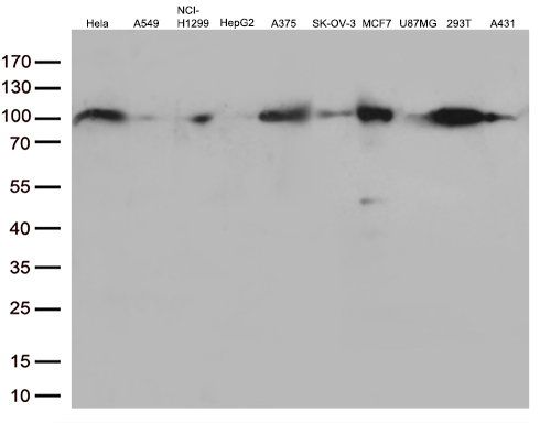 EWSR1 / EWS Antibody - Western blot analysis of extracts. (35ug) from 10 different cell lines by using anti-EWSR1 monoclonal antibody. (1:500)