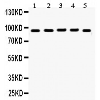EWSR1 / EWS Antibody - EWSR1 antibody Western blot. All lanes: Anti EWSR1 at 0.5 ug/ml. Lane 1: Rat Brain Tissue Lysate at 50 ug. Lane 2: Rat Testis Tissue Lysate at 50 ug. Lane 3: HELA Whole Cell Lysate at 40 ug. Lane 4: SKOV Whole Cell Lysate at 40 ug. Lane 5: SW620 Whole Cell Lysate at 40 ug. Predicted band size: 68 kD. Observed band size: 95 kD.