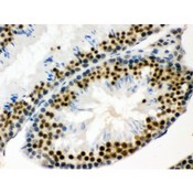 EWSR1 / EWS Antibody - EWSR1 antibody IHC-paraffin. IHC(P): Mouse Testis Tissue.