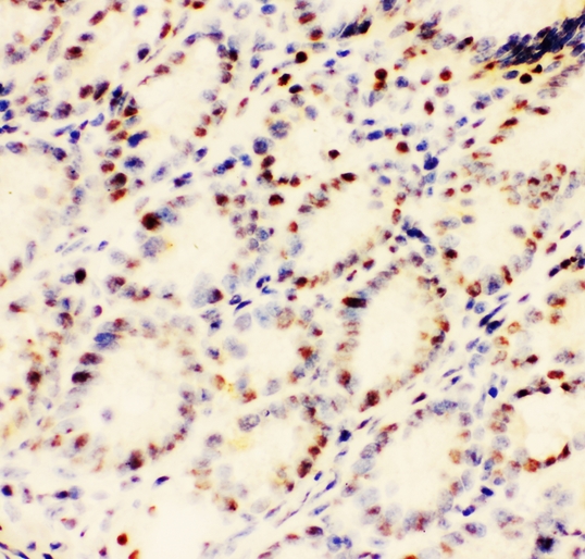 EWSR1 / EWS Antibody - IHC analysis of EWSR1 using anti-EWSR1 antibody. EWSR1 was detected in frozen section of mouse intestine tissues. Heat mediated antigen retrieval was performed in citrate buffer (pH6, epitope retrieval solution) for 20 mins. The tissue section was blocked with 10% goat serum. The tissue section was then incubated with 1µg/ml rabbit anti-EWSR1 Antibody overnight at 4°C. Biotinylated goat anti-rabbit IgG was used as secondary antibody and incubated for 30 minutes at 37°C. The tissue section was developed using Strepavidin-Biotin-Complex (SABC) with DAB as the chromogen.