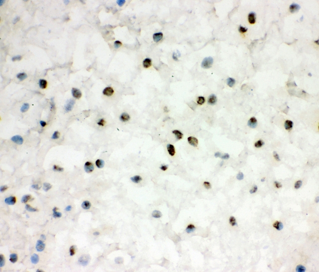 EWSR1 / EWS Antibody - IHC analysis of EWSR1 using anti-EWSR1 antibody. EWSR1 was detected in frozen section of human placenta tissues. Heat mediated antigen retrieval was performed in citrate buffer (pH6, epitope retrieval solution) for 20 mins. The tissue section was blocked with 10% goat serum. The tissue section was then incubated with 1µg/ml rabbit anti-EWSR1 Antibody overnight at 4°C. Biotinylated goat anti-rabbit IgG was used as secondary antibody and incubated for 30 minutes at 37°C. The tissue section was developed using Strepavidin-Biotin-Complex (SABC) with DAB as the chromogen.
