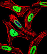 EWSR1 / EWS Antibody - Fluorescent confocal image of HeLa cell stained with EWSR1 Antibody. HeLa cells were fixed with 4% PFA (20 min), permeabilized with Triton X-100 (0.1%, 10 min), then incubated with EWSR1 primary antibody (1:25, 1 h at 37°C). For secondary antibody, Alexa Fluor 488 conjugated donkey anti-rabbit antibody (green) was used (1:400, 50 min at 37°C). Cytoplasmic actin was counterstained with Alexa Fluor 555 (red) conjugated Phalloidin (7units/ml, 1 h at 37°C). Nuclei were counterstained with DAPI (blue) (10 ug/ml, 10 min). EWSR1 immunoreactivity is localized to Nucleus significantly.