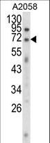 EWSR1 / EWS Antibody - Western blot of EWSR1 Antibody in A2058 cell line lysates (35 ug/lane). EWSR1 (arrow) was detected using the purified antibody.