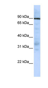 EWSR1 / EWS Antibody - EWSR1 antibody Western blot of Jurkat lysate. This image was taken for the unconjugated form of this product. Other forms have not been tested.