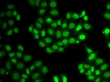 EWSR1 / EWS Antibody - Immunofluorescence analysis of HeLa cells.