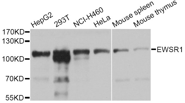EWSR1 / EWS Antibody - Western blot analysis of extracts of various cell lines, using EWSR1 antibody at 1:1000 dilution. The secondary antibody used was an HRP Goat Anti-Rabbit IgG (H+L) at 1:10000 dilution. Lysates were loaded 25ug per lane and 3% nonfat dry milk in TBST was used for blocking. An ECL Kit was used for detection and the exposure time was 1s.