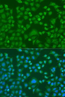 EWSR1 / EWS Antibody - Immunofluorescence analysis of U2OS cells using EWSR1 antibodyat dilution of 1:100. Blue: DAPI for nuclear staining.