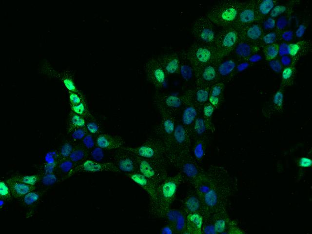EWSR1 / EWS Antibody - Immunofluorescence staining of EWSR1 in A431 cells. Cells were fixed with 4% PFA, permeabilzed with 0.1% Triton X-100 in PBS, blocked with 10% serum, and incubated with rabbit anti-Human EWSR1 polyclonal antibody (dilution ratio 1:200) at 4°C overnight. Then cells were stained with the Alexa Fluor 488-conjugated Goat Anti-rabbit IgG secondary antibody (green) and counterstained with DAPI (blue). Positive staining was localized to Nucleus.