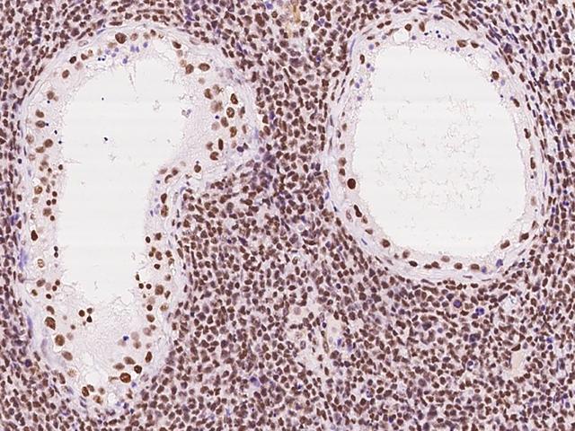 EWSR1 / EWS Antibody - Immunochemical staining of human EWSR1 in human testis with rabbit polyclonal antibody at 1:200 dilution, formalin-fixed paraffin embedded sections.