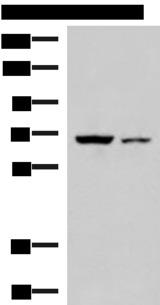 EWSR1 / EWS Antibody - Western blot analysis of 293T and HepG2 cell lysates  using EWSR1 Polyclonal Antibody at dilution of 1:1000