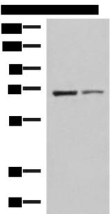 EWSR1 / EWS Antibody - Western blot analysis of K562 and HepG2 cell lysates  using EWSR1 Polyclonal Antibody at dilution of 1:1000