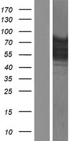 EWSR1 / EWS Protein - Western validation with an anti-DDK antibody * L: Control HEK293 lysate R: Over-expression lysate
