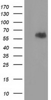 EXD1 Antibody - HEK293T cells were transfected with the pCMV6-ENTRY control (Left lane) or pCMV6-ENTRY EXD1 (Right lane) cDNA for 48 hrs and lysed. Equivalent amounts of cell lysates (5 ug per lane) were separated by SDS-PAGE and immunoblotted with anti-EXD1.