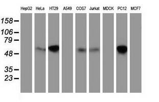 EXD1 Antibody - Western blot of extracts (35ug) from 9 different cell lines by using anti-EXD1 monoclonal antibody.
