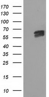 EXD1 Antibody - HEK293T cells were transfected with the pCMV6-ENTRY control (Left lane) or pCMV6-ENTRY EXD1 (Right lane) cDNA for 48 hrs and lysed. Equivalent amounts of cell lysates (5 ug per lane) were separated by SDS-PAGE and immunoblotted with anti-EXD1.