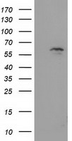 EXD1 Antibody - HEK293T cells were transfected with the pCMV6-ENTRY control (Left lane) or pCMV6-ENTRY EXD1 (Right lane) cDNA for 48 hrs and lysed. Equivalent amounts of cell lysates (5 ug per lane) were separated by SDS-PAGE and immunoblotted with anti-EXD1.
