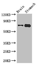 EXD2 Antibody - Western Blot Positive WB detected in:Mouse brain tissue,Mouse stomach tissue All Lanes: EXD2 antibody at 2.8ug/ml Secondary Goat polyclonal to rabbit IgG at 1/50000 dilution Predicted band size: 71,57 kDa Observed band size: 71 kDa