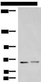 EXD2 Antibody - Western blot analysis of Mouse brain tissue and Human cerebrum tissue lysates  using EXD2 Polyclonal Antibody at dilution of 1:700