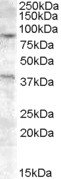EXO1 Antibody - Antibody (0.2 ug/ml) staining of A549 cell lysate (35 ug protein in RIPA buffer). Primary incubation was 1 hour. Detected by chemiluminescence.