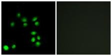 EXO1 Antibody - Immunofluorescence analysis of A549 cells, using EXO1 Antibody. The picture on the right is blocked with the synthesized peptide.