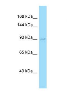 EXO1 Antibody - EXO1 antibody Western blot of Fetal Liver lysate. Antibody concentration 1 ug/ml.  This image was taken for the unconjugated form of this product. Other forms have not been tested.