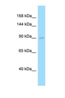 EXO1 Antibody - EXO1 antibody Western blot of Fetal Liver lysate. Antibody concentration 1 ug/ml.  This image was taken for the unconjugated form of this product. Other forms have not been tested.