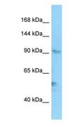 EXO1 Antibody - EXO1 antibody Western Blot of A549. Antibody dilution: 1 ug/ml.  This image was taken for the unconjugated form of this product. Other forms have not been tested.