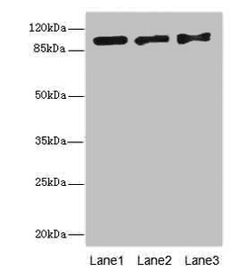 EXO1 Antibody - Western blot All lanes: EXO1 antibody at 10µg/ml Lane 1: Hela whole cell lysate Lane 2: 293T whole cell lysate Lane 3: A549 whole cell lysate Secondary Goat polyclonal to rabbit IgG at 1/10000 dilution Predicted band size: 95, 90 kDa Observed band size: 95 kDa