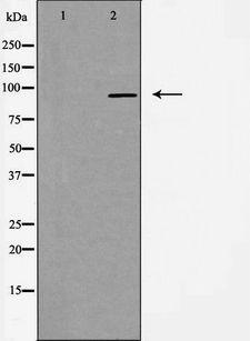 EXO1 Antibody - Western blot analysis of extracts of A549 cells using EXO1 antibody. The lane on the left is treated with the antigen-specific peptide.