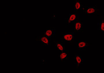 EXO1 Antibody - Staining A549 cells by IF/ICC. The samples were fixed with PFA and permeabilized in 0.1% Triton X-100, then blocked in 10% serum for 45 min at 25°C. The primary antibody was diluted at 1:200 and incubated with the sample for 1 hour at 37°C. An Alexa Fluor 594 conjugated goat anti-rabbit IgG (H+L) Ab, diluted at 1/600, was used as the secondary antibody.