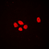 EXO1 Antibody - Immunofluorescent analysis of EXO1 staining in A431 cells. Formalin-fixed cells were permeabilized with 0.1% Triton X-100 in TBS for 5-10 minutes and blocked with 3% BSA-PBS for 30 minutes at room temperature. Cells were probed with the primary antibody in 3% BSA-PBS and incubated overnight at 4 C in a humidified chamber. Cells were washed with PBST and incubated with a DyLight 594-conjugated secondary antibody (red) in PBS at room temperature in the dark. DAPI was used to stain the cell nuclei (blue).
