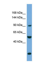 EXOC1 / SEC3 Antibody - EXOC1 antibody Western blot of HeLa lysate. This image was taken for the unconjugated form of this product. Other forms have not been tested.