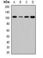 EXOC2 / SEC5 Antibody - Western blot analysis of Sec5 expression in MCF7 (A); HeLa (B); mouse lung (C); rat brain (D) whole cell lysates.