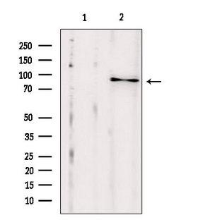 EXOC2 / SEC5 Antibody - Western blot analysis of extracts of HepG2 cells using SEC5/EXOC2 antibody. Lane 1 was treated with the blocking peptide.