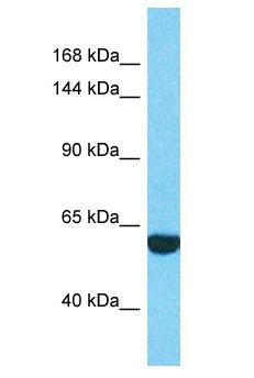 EXOC2 / SEC5 Antibody - EXOC2 / SEC5 antibody Western Blot of 721_B. Antibody dilution: 1 ug/ml.  This image was taken for the unconjugated form of this product. Other forms have not been tested.
