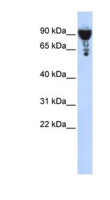 EXOC3 / SEC6 Antibody - EXOC3 antibody Western blot of HeLa lysate. This image was taken for the unconjugated form of this product. Other forms have not been tested.
